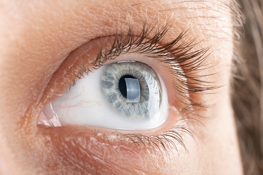 Close up cornea with blue iris