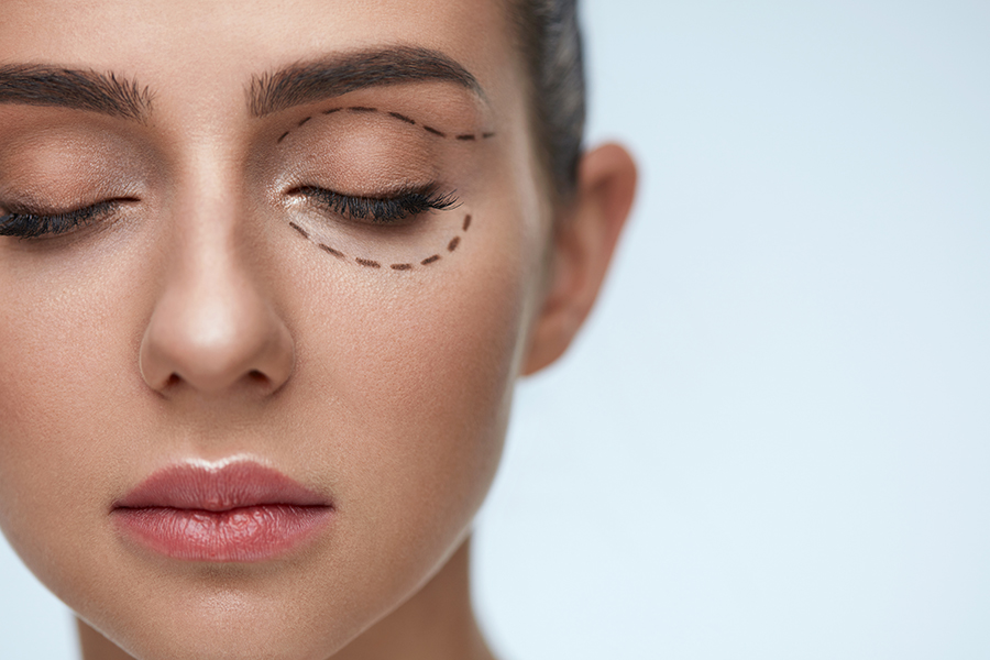 Eyelid surgery (blepharoplasty)